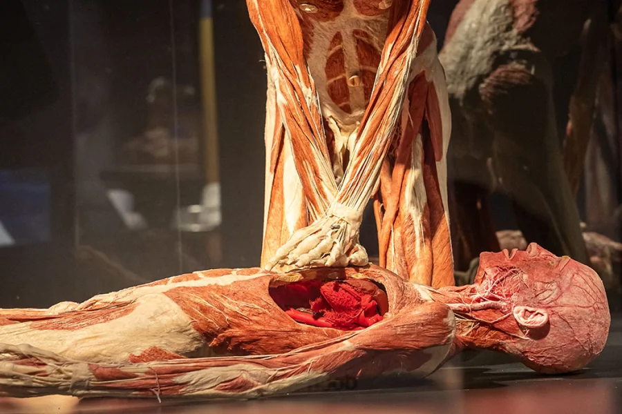 Koerperwelten-Szene einer Wiederbelebung: ein stehendes Plastinat drueckt mit gestreckten Armen auf den Brustkorb eines liegenden Plastinats mit sichtbaren Organen